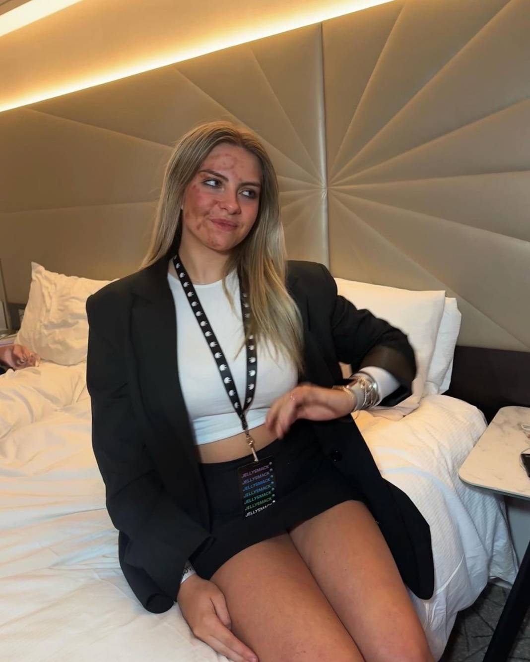 Basit bir uçuk zannetti, korkunç hastalığa yakalandı! Doktorlar bile teşhis koyamadı 20